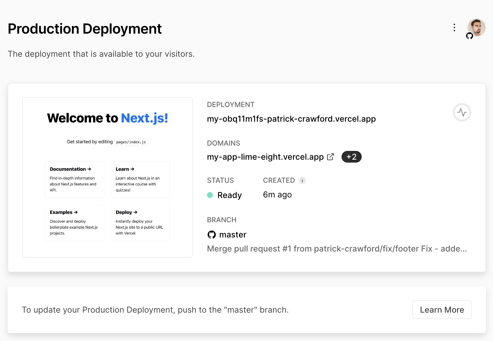 Vercel Dashboard for my-app